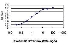 Anti-LIMK1 Mouse Monoclonal Antibody [clone: 1A8]