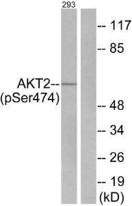 Western blot analysis of lysates from 293 cells treated with EGF 200ng/ml 30' using Anti-Akt2 (phospho Ser474) Antibody. The right hand lane represents a negative control, where the antibody is blocked by the immunising peptide.