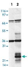 Anti-HDLBP Rabbit Polyclonal Antibody