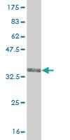 Anti-TRIM49 Mouse Monoclonal Antibody [clone: 3H8]