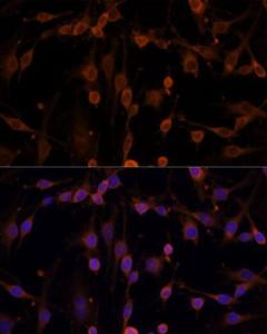 Immunofluorescence analysis of C6 cells using Anti-NM23A Antibody (A307500) at a dilution of 1:100. DAPI was used to stain the cell nuclei (blue)