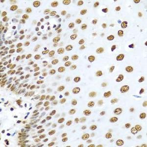 Immunohistochemistry analysis of paraffin-embedded human esophagus using Anti-hnRNP R Antibody (A308450) at a dilution of 1:100 (40X lens). Perform microwave antigen retrieval with 10 mM PBS buffer pH 7.2 before commencing with IHC staining protocol