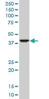 Anti-RNF2 Mouse Monoclonal Antibody [clone: 4A9]