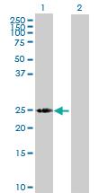 Anti-LOC391763 Mouse Polyclonal Antibody