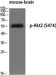 Western blot analysis of various cells using Anti-Akt2 (phospho Ser474) Antibody