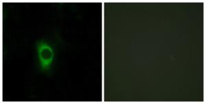 Immunofluorescence analysis of HeLa cells using Anti-5-HT-2B Antibody. The right hand panel represents a negative control, where the antibody was pre-incubated with the immunising peptide.