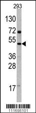 Anti-FIGF Rabbit Polyclonal Antibody