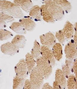 Anti-CDKN1B Mouse Monoclonal Antibody [clone: 1373CT407.103.103]