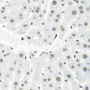 Immunohistochemistry analysis of paraffin-embedded mouse liver using Anti-hnRNP R Antibody (A308450) at a dilution of 1:100 (40X lens). Perform microwave antigen retrieval with 10 mM PBS buffer pH 7.2 before commencing with IHC staining protocol