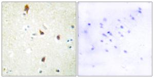 Immunohistochemical analysis of paraffin-embedded human brain tissue using Anti-5-HT-2B Antibody. The right hand panel represents a negative control, where the antibody was pre-incubated with the immunising peptide.