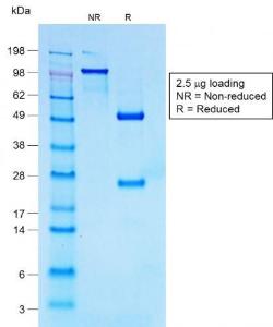 SDS-PAGE analysis of Anti-CD30 Antibody [Ki-1/1747R] under non-reduced and reduced conditions; showing intact IgG and intact heavy and light chains, respectively. SDS-PAGE analysis confirms the integrity and purity of the antibody.