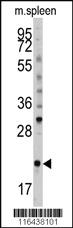 Anti-BID Rabbit Polyclonal Antibody