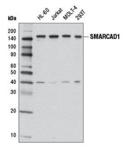 Anti-SMARCAD1 Rabbit Polyclonal Antibody