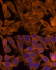 Immunofluorescence analysis of HeLa cells using Anti-NM23A Antibody (A307500) at a dilution of 1:100. DAPI was used to stain the cell nuclei (blue)