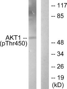 Anti-Akt1