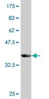 Anti-SLC33A1 Mouse Monoclonal Antibody [clone: 3A4]