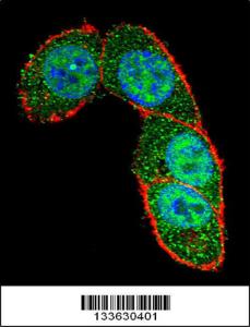 Anti-SMAD3 Rabbit Polyclonal Antibody (AP (Alkaline Phosphatase))