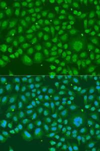 Immunofluorescence analysis of U2OS cells using Anti-hnRNP R Antibody (A308450) at a dilution of 1:100. DAPI was used to stain the cell nuclei (blue)