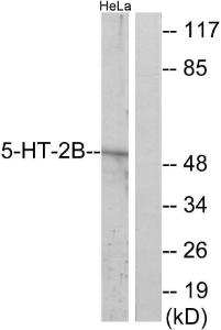 Western blot analysis of lysates from HeLa cells using Anti-5-HT-2B Antibody. The right hand lane represents a negative control, where the antibody is blocked by the immunising peptide.