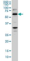 Anti-RBBP4 Mouse Monoclonal Antibody [clone: 4A5]