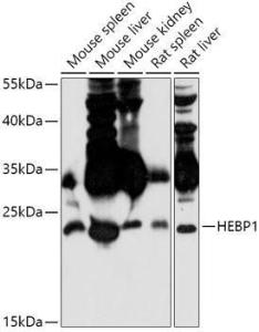 Anti-HBP Rabbit Polyclonal Antibody