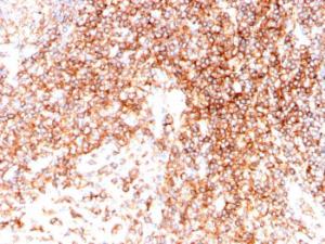 Immunohistochemical analysis of formalin-fixed, paraffin-embedded human tonsil tissue using Anti-CD48 Antibody [CD48/4786]