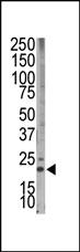 Anti-BCL2L11 Rabbit Polyclonal Antibody