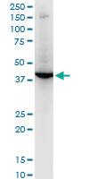 Anti-RNF2 Mouse Monoclonal Antibody [clone: 4A9]