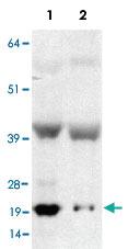 Anti-CRYAB Rabbit Polyclonal Antibody