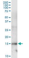 Anti-UBE2L6 Polyclonal Antibody Pair