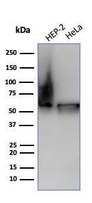 Western blot analysis of (Lane 1) Hep2 cell line lysate and (Lane 2) HeLa cell line lysate using Anti-HSP60 Antibody [HSPD1/6498R]