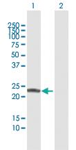 Anti-COMT Rabbit Polyclonal Antibody