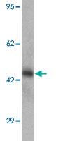 Anti-CMPK2 Rabbit Polyclonal Antibody