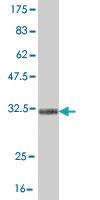 Anti-TRIM49 Mouse Monoclonal Antibody [clone: 3C7]