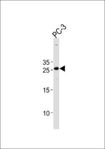 Anti-HOXC6 Rabbit Polyclonal Antibody (FITC (Fluorescein Isothiocyanate))