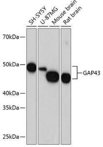 Western blot analysis of extracts of various cell lines, using Anti-GAP43 Antibody [ARC0246] (A305811) at 1:1,000 dilution. The secondary antibody was Goat Anti-Rabbit IgG H&L Antibody (HRP) at 1:10,000 dilution.