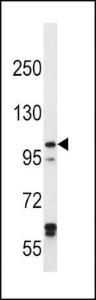 Anti-IREB2 Rabbit Polyclonal Antibody (FITC (Fluorescein Isothiocyanate))