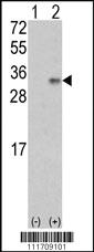 Anti-VEGFB Rabbit Polyclonal Antibody