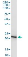 Anti-COMT Rabbit Polyclonal Antibody