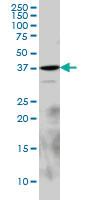 Anti-EPM2A Mouse Monoclonal Antibody [clone: 6C6]