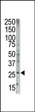 Anti-BOK Rabbit Polyclonal Antibody