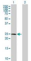 Anti-COMT Rabbit Polyclonal Antibody