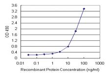 Anti-SERPINA3 Mouse Monoclonal Antibody (Biotin)