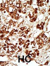 Anti-MLKLAK Rabbit Polyclonal Antibody (AP (Alkaline Phosphatase))