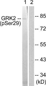 Western blot analysis of lysates from Jurkat cells treated with EGF 200 ng/ml 30' using Anti-GRK2 (phospho Ser29) Antibody. The right hand lane represents a negative control, where the Antibody is blocked by the immunising peptide