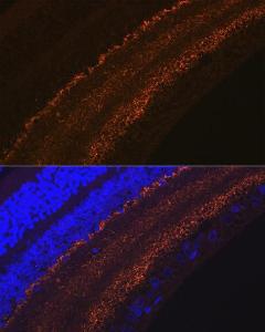 Immunofluorescence analysis of rat retina using Anti-GAP43 Antibody [ARC0246] (A305811) at a dilution of 1:100 (40x lens). DAPI was used to stain the cell nuclei (blue).