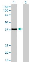 Anti-EPM2A Mouse Monoclonal Antibody [clone: 6C6]