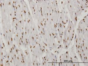 Anti-TAF11 Mouse Monoclonal Antibody [clone: 3H5]