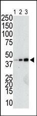 Anti-Glutathione S Transferase Rabbit Polyclonal Antibody (FITC (Fluorescein))