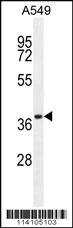 Anti-CD14 Rabbit Polyclonal Antibody